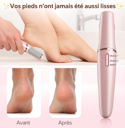 Lime Électrique pour vos talons secs, callosités et à la peau dure